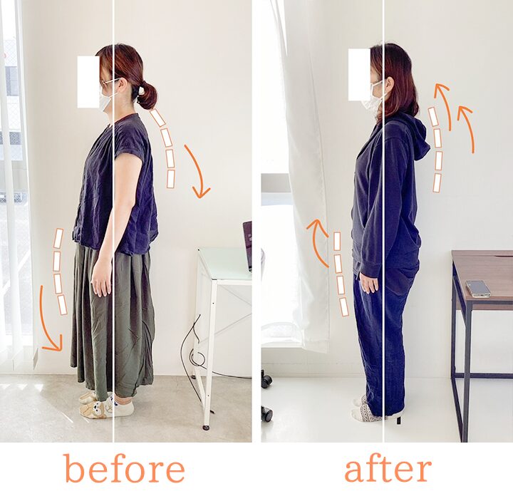 ビフォーアフター