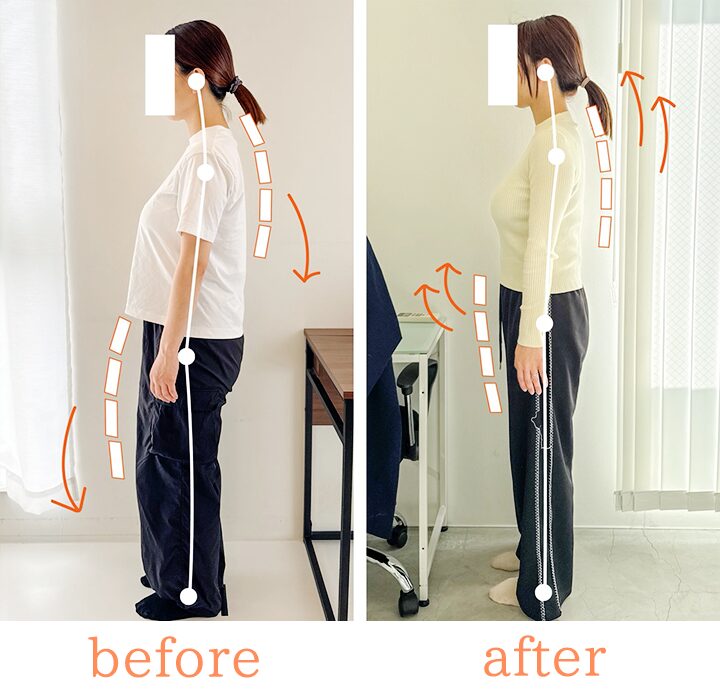 ビフォーアフター