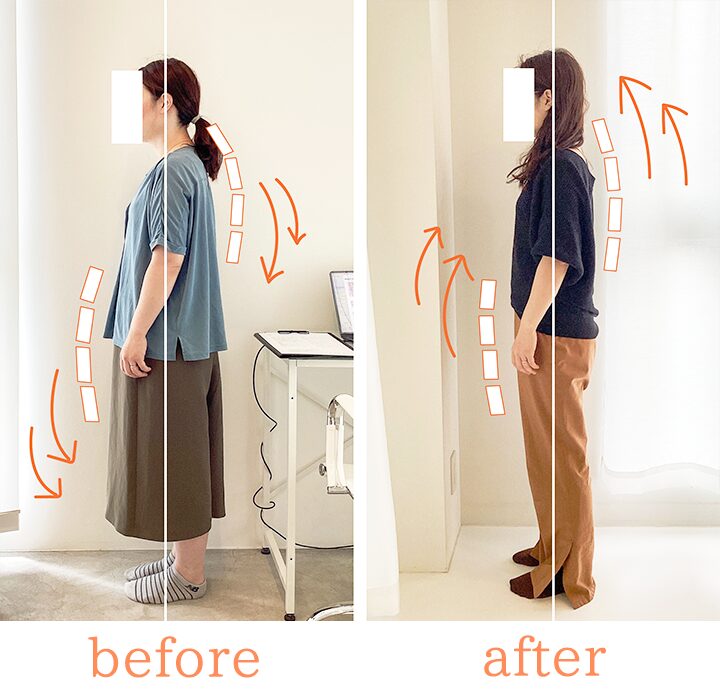 ビフォーアフター