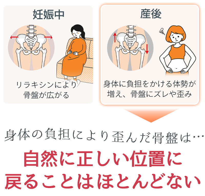 骨盤が歪む過程イメージ