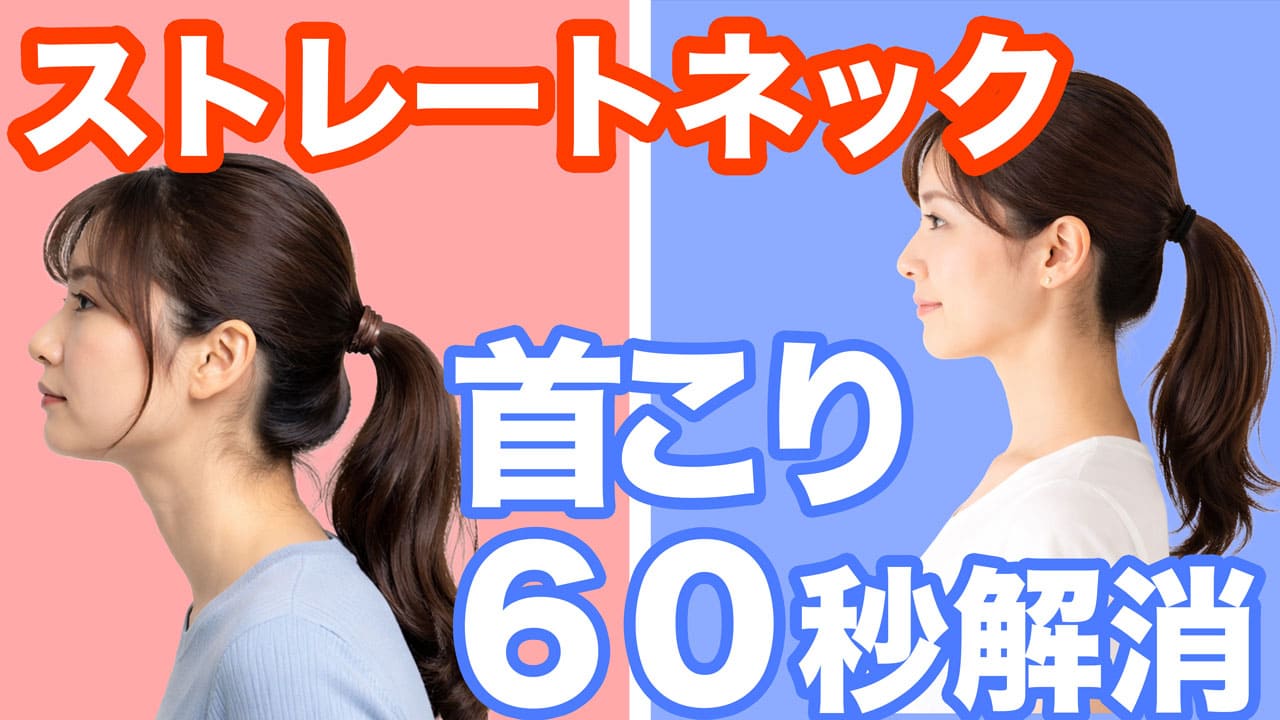 ストレートネック 都城